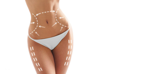 Liposuktion Niederbayern