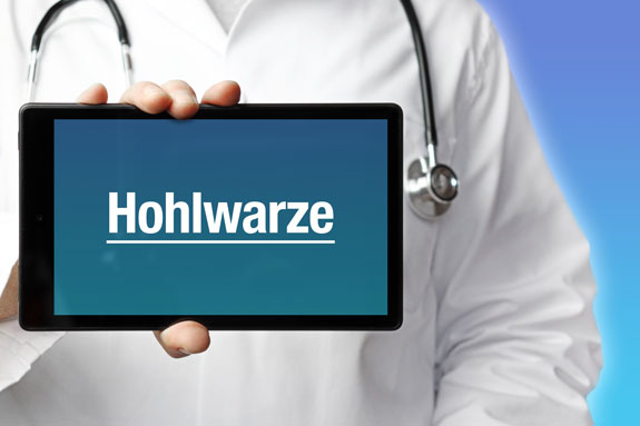 Schlupfwarzenkorrektur Niederbayern